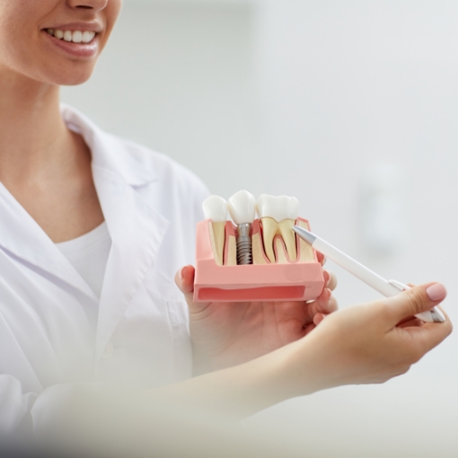 Dentist using model to explain tooth replacement with dental implants