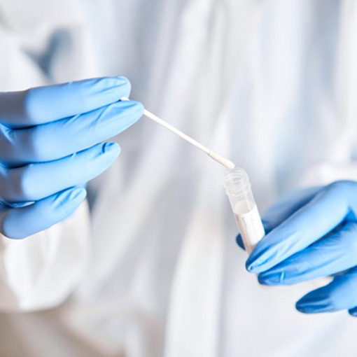 Dentist handling a saliva sample